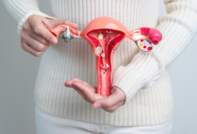 Dra. Thaline Neves explica como o ultrassom pode ajudar no diagnóstico da endometriose e quais são suas limitações.